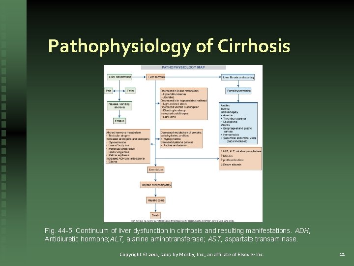 Pathophysiology of Cirrhosis Fig. 44 -5. Continuum of liver dysfunction in cirrhosis and resulting