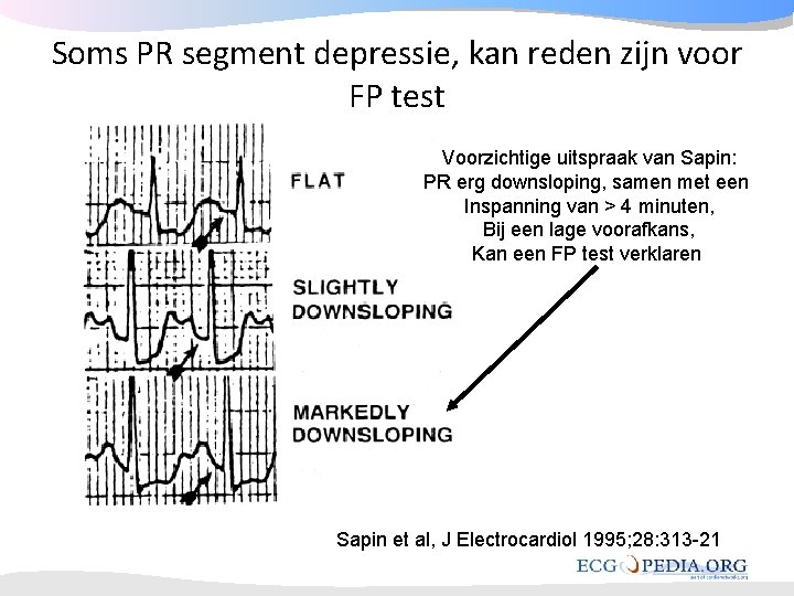 Soms PR segment depressie, kan reden zijn voor FP test Voorzichtige uitspraak van Sapin: Soms PR segment depressie, kan reden zijn voor FP test Voorzichtige uitspraak van Sapin: