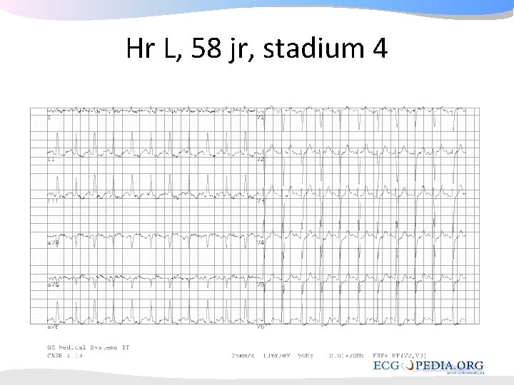Hr L, 58 jr, stadium 4 Hr L, 58 jr, stadium 4
