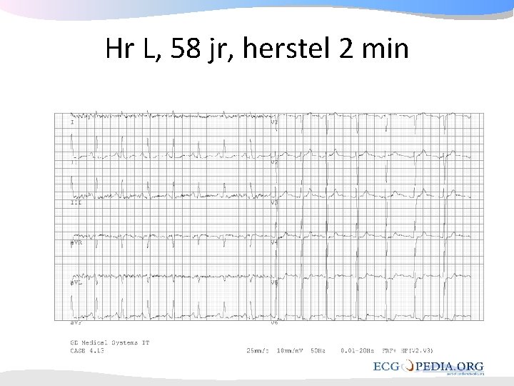 Hr L, 58 jr, herstel 2 min Hr L, 58 jr, herstel 2 min
