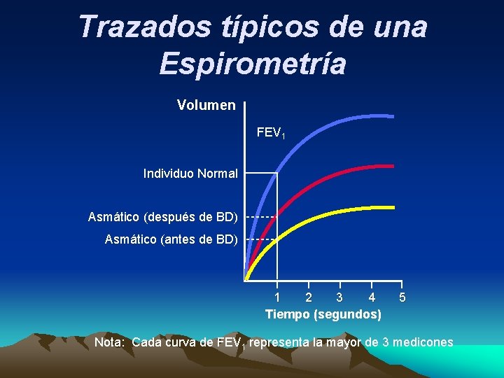 Trazados típicos de una Espirometría Volumen FEV 1 Individuo Normal Asmático (después de BD)