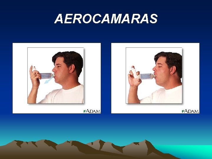 AEROCAMARAS 