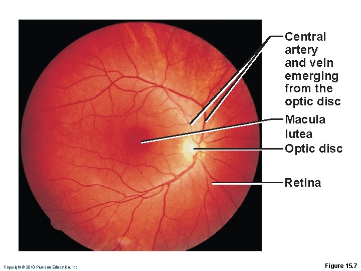 Central artery and vein emerging from the optic disc Macula lutea Optic disc Retina Central artery and vein emerging from the optic disc Macula lutea Optic disc Retina