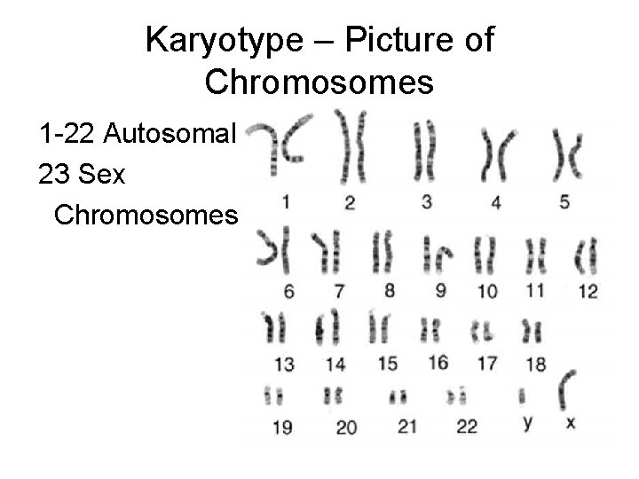 Karyotype – Picture of Chromosomes 1 -22 Autosomal 23 Sex Chromosomes 