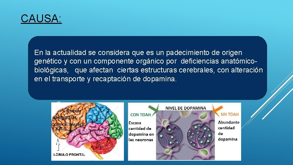 CAUSA: En la actualidad se considera que es un padecimiento de origen genético y