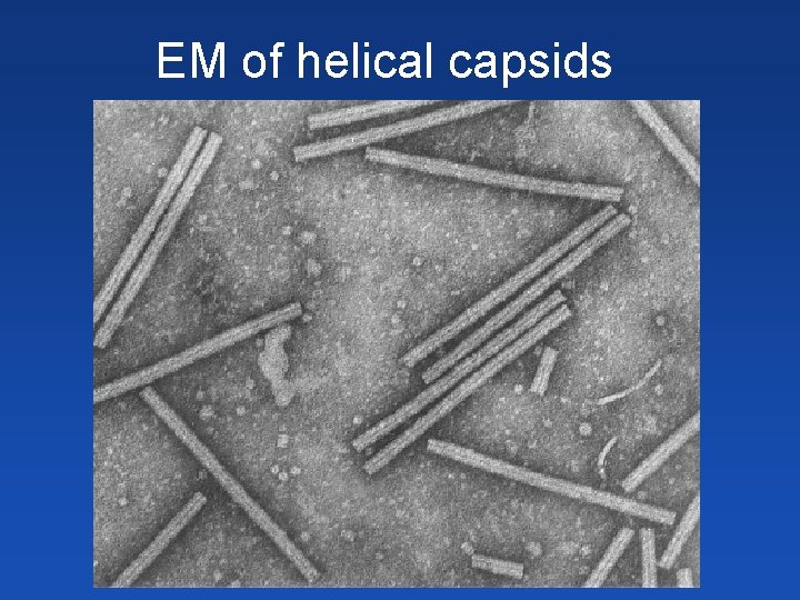 EM of helical capsids EM of helical capsids