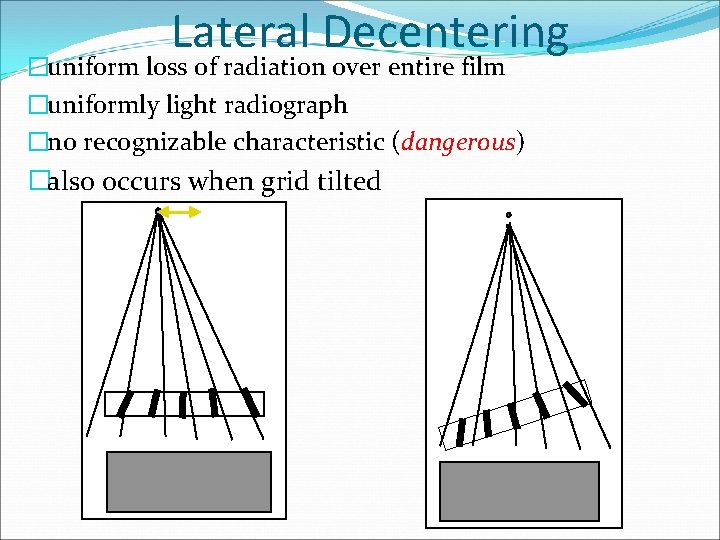 Lateral Decentering �uniform loss of radiation over entire film �uniformly light radiograph �no recognizable