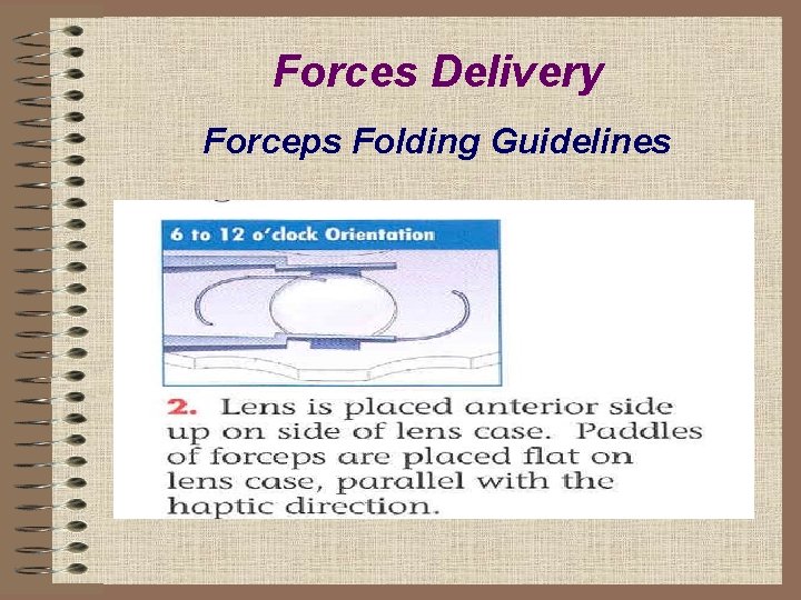 Forces Delivery Forceps Folding Guidelines 