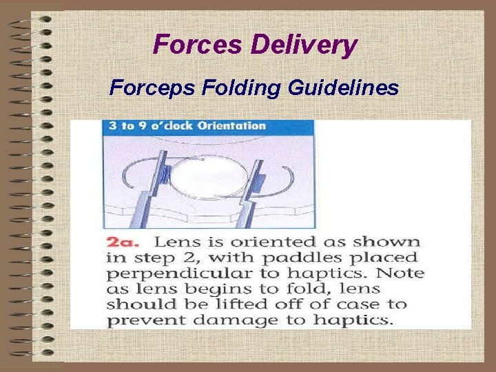 Forces Delivery Forceps Folding Guidelines 