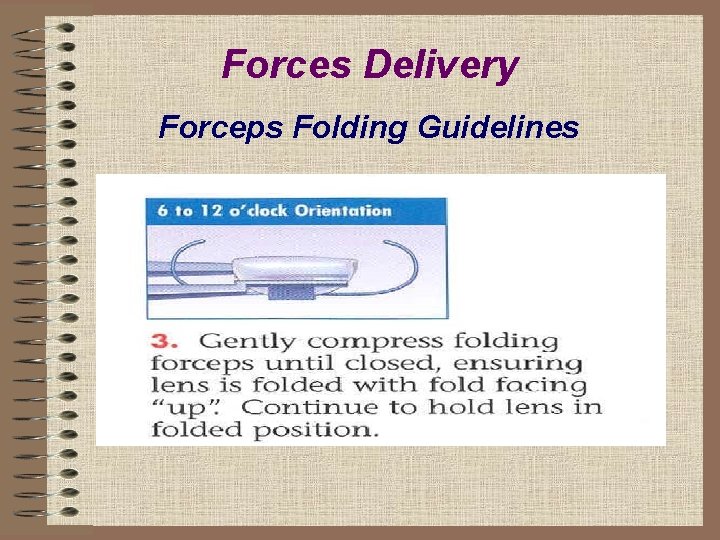 Forces Delivery Forceps Folding Guidelines 