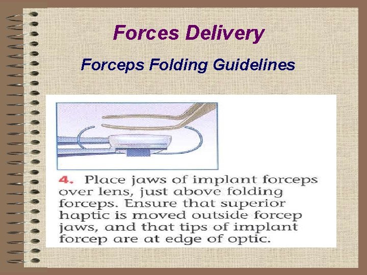 Forces Delivery Forceps Folding Guidelines 