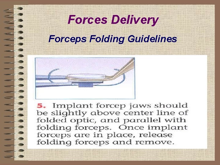 Forces Delivery Forceps Folding Guidelines 