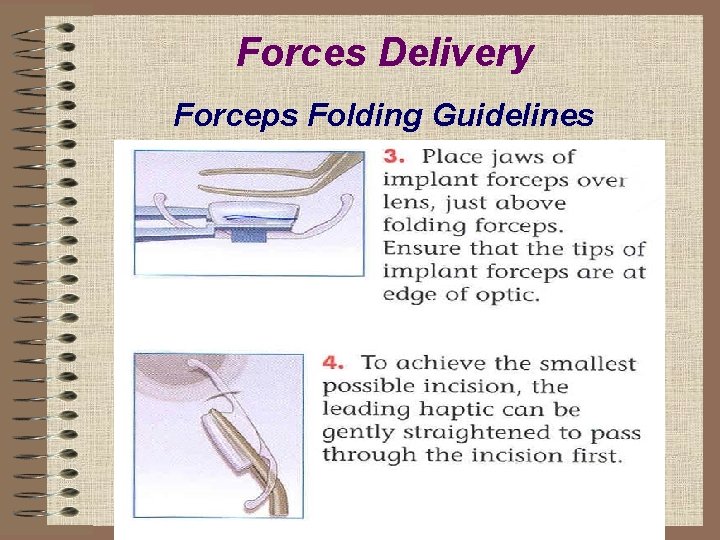 Forces Delivery Forceps Folding Guidelines 