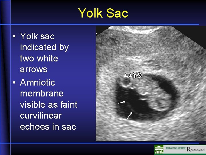 Yolk Sac • Yolk sac indicated by two white arrows • Amniotic membrane visible