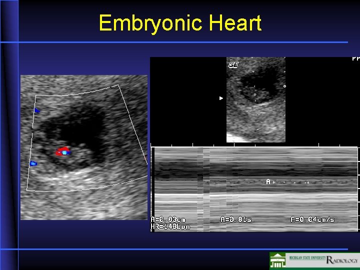 Embryonic Heart 25 