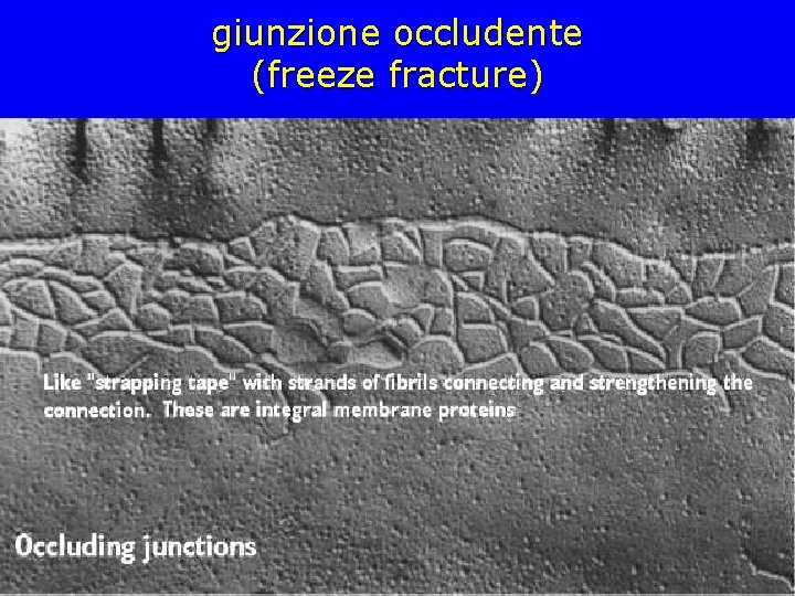 giunzione occludente (freeze fracture) 