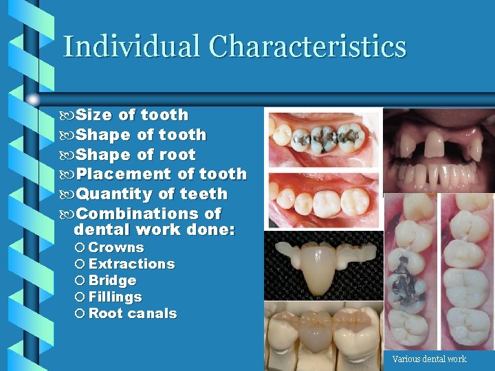 Individual Characteristics Size of tooth Shape of root Placement of tooth Quantity of teeth