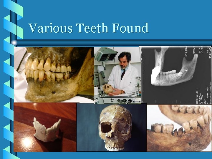 Various Teeth Found 