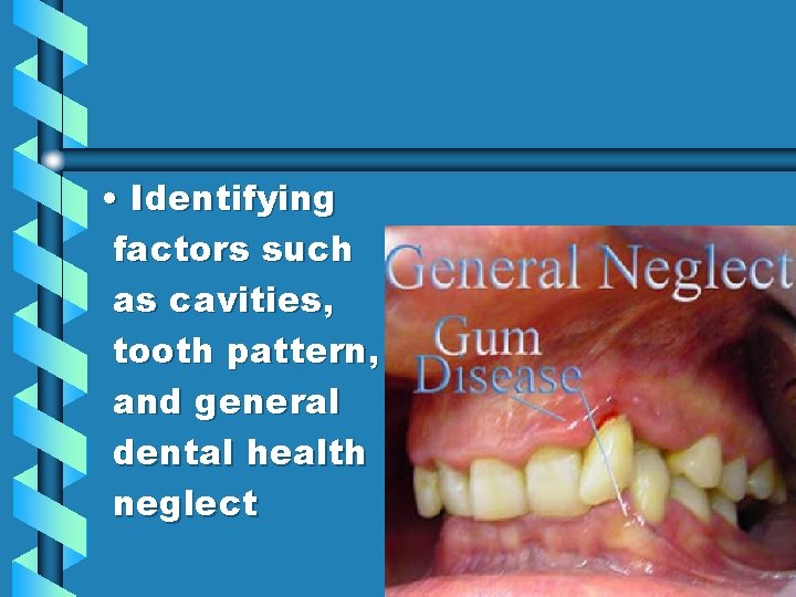 • Identifying factors such as cavities, tooth pattern, and general dental health neglect