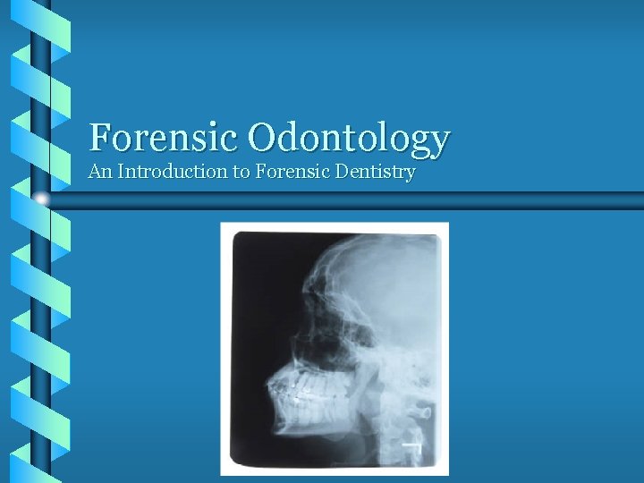 Forensic Odontology An Introduction to Forensic Dentistry 