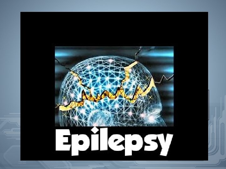 Epilepsi 