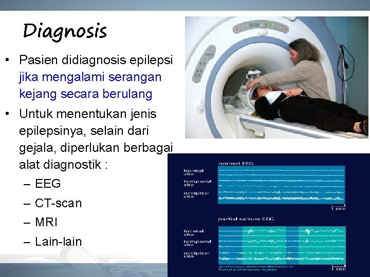 Diagnosis • Pasien didiagnosis epilepsi jika mengalami serangan kejang secara berulang • Untuk menentukan