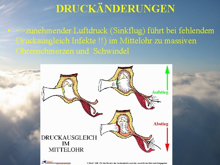 DRUCKÄNDERUNGEN • =>zunehmender Luftdruck (Sinkflug) führt bei fehlendem Druckausgleich Infekte !!) im Mittelohr zu