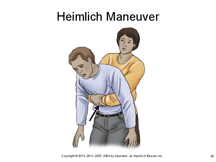 Heimlich Maneuver Copyright © 2013, 2011, 2007, 2003 by Saunders, an imprint of Elsevier