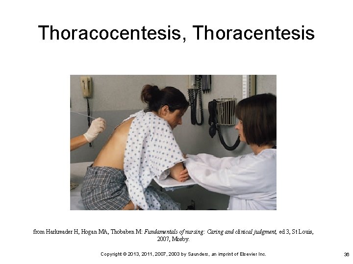 Thoracocentesis, Thoracentesis from Harkreader H, Hogan MA, Thobaben M: Fundamentals of nursing: Caring and