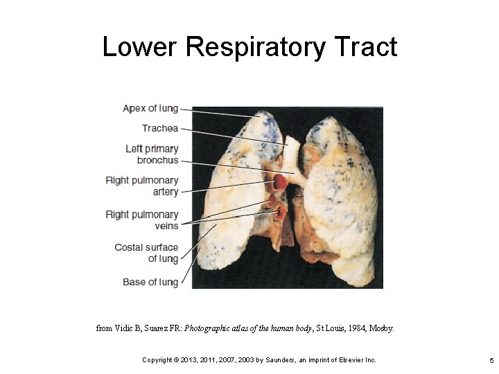 Lower Respiratory Tract from Vidic B, Suarez FR: Photographic atlas of the human body,