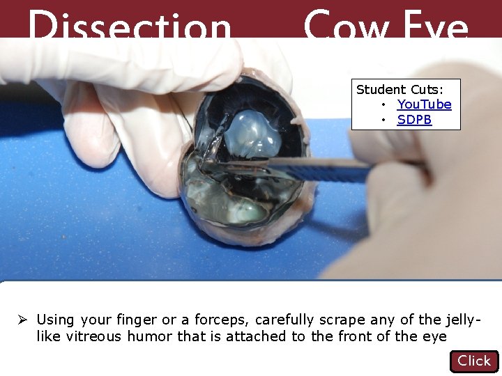 Dissection 101: Vitreous humor removed, retina against the back of the eye Cow Eye