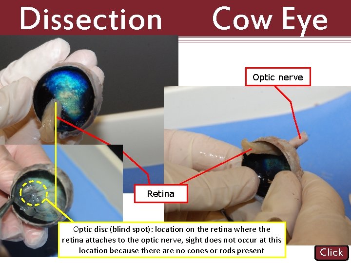 Dissection 101: Cow Eye Optic nerve Retina Optic disc (blind spot): location on the