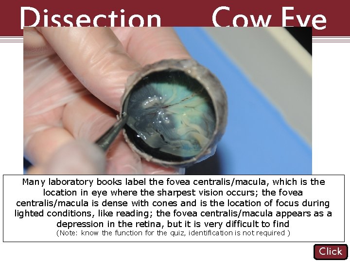 Dissection 101: Cow Eye Many laboratory books label the fovea centralis/macula, which is the