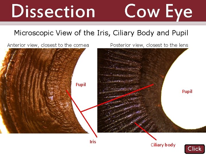 Dissection 101: Cow Eye Microscopic View of the Iris, Ciliary Body and Pupil Anterior