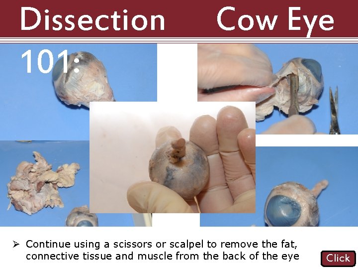 Dissection 101: Cow Eye Ø Continue using a scissors or scalpel to remove the