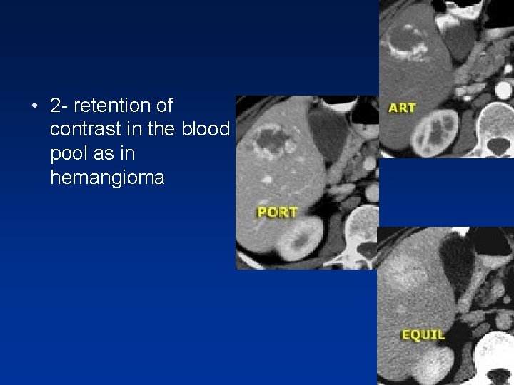 • 2 - retention of contrast in the blood pool as in hemangioma • 2 - retention of contrast in the blood pool as in hemangioma