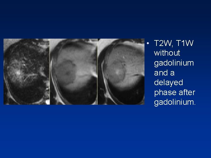 • T 2 W, T 1 W without gadolinium and a delayed phase • T 2 W, T 1 W without gadolinium and a delayed phase