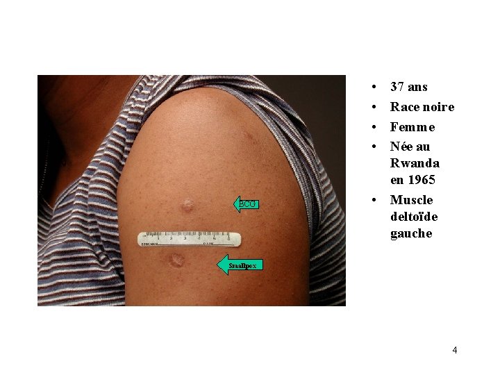  • • BCG 37 ans Race noire Femme Née au Rwanda en 1965