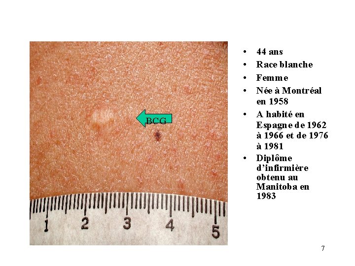  • • BCG 44 ans Race blanche Femme Née à Montréal en 1958