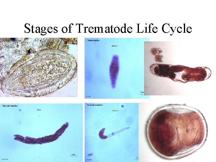 Stages of Trematode Life Cycle • . Stages of Trematode Life Cycle • .