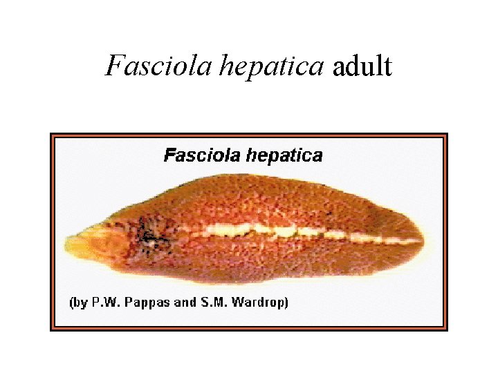 Fasciola hepatica adult Fasciola hepatica adult