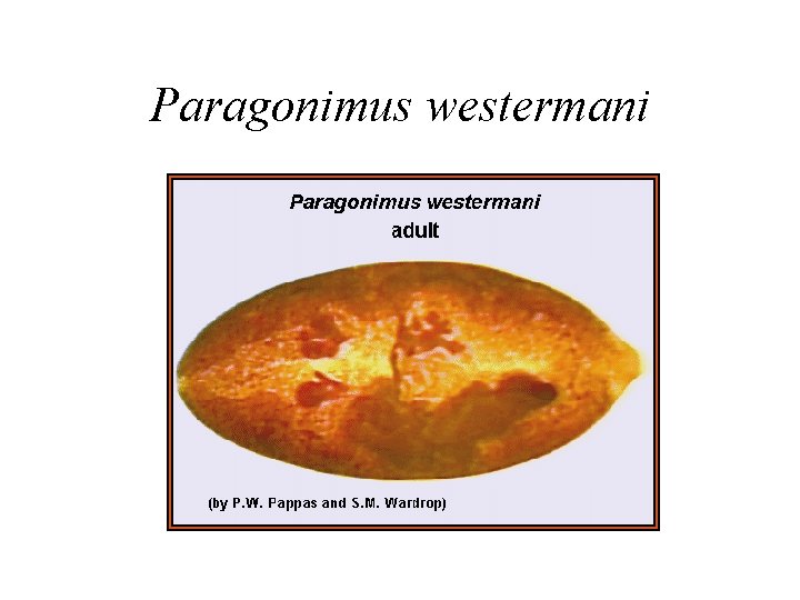 Paragonimus westermani Paragonimus westermani