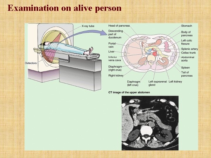 Examination on alive person 