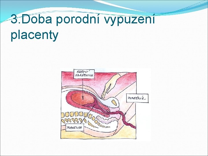 3. Doba porodní vypuzení placenty 