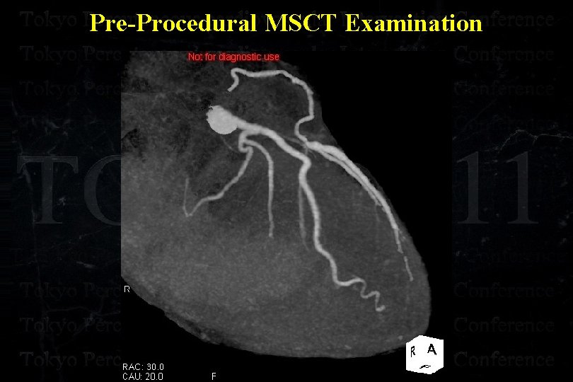 Pre-Procedural MSCT Examination 