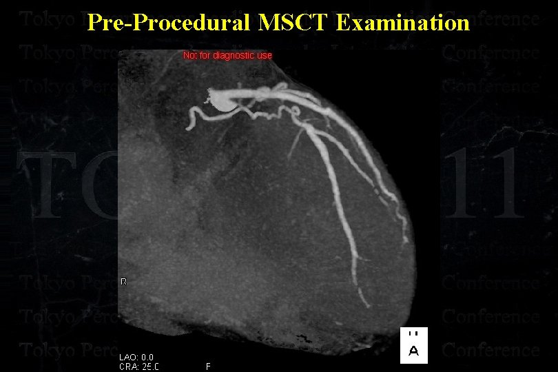 Pre-Procedural MSCT Examination 