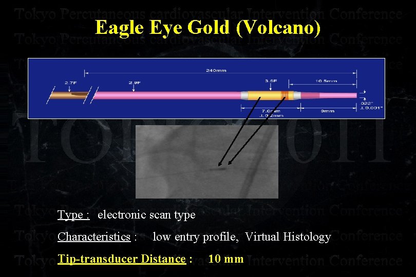 Eagle Eye Gold (Volcano) Type : 　electronic scan type Characteristics : low entry profile,