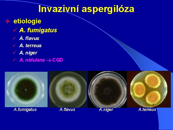 Invazivní aspergilóza v etiologie ü A. fumigatus ü A. flavus ü A. terreus ü