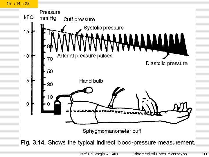 Prof. Dr. Sezgin ALSAN Biyomedikal Enstrümantasyon 33 