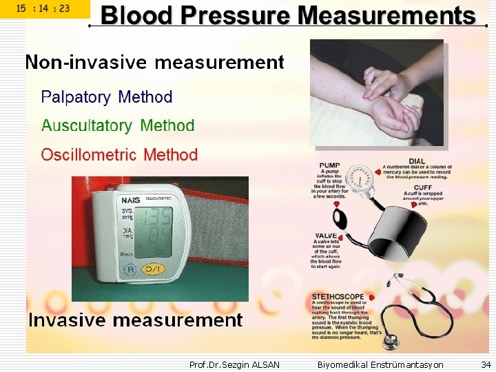 Prof. Dr. Sezgin ALSAN Biyomedikal Enstrümantasyon 34 